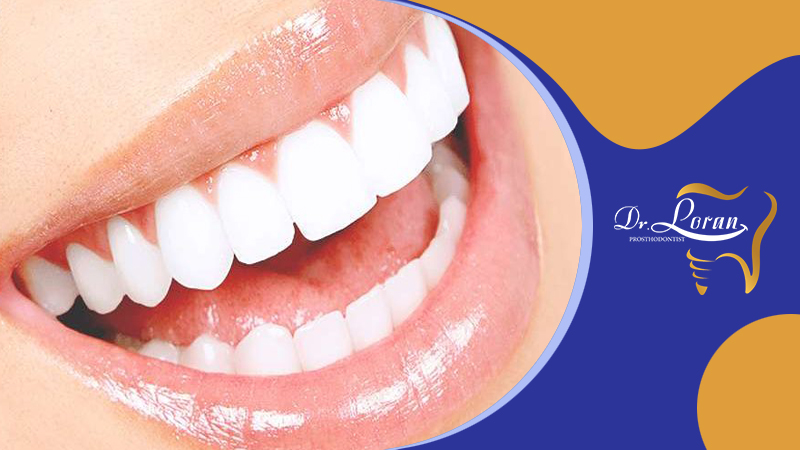 چه اتفاقی در حین عمل ونیر دندان می افتد؟