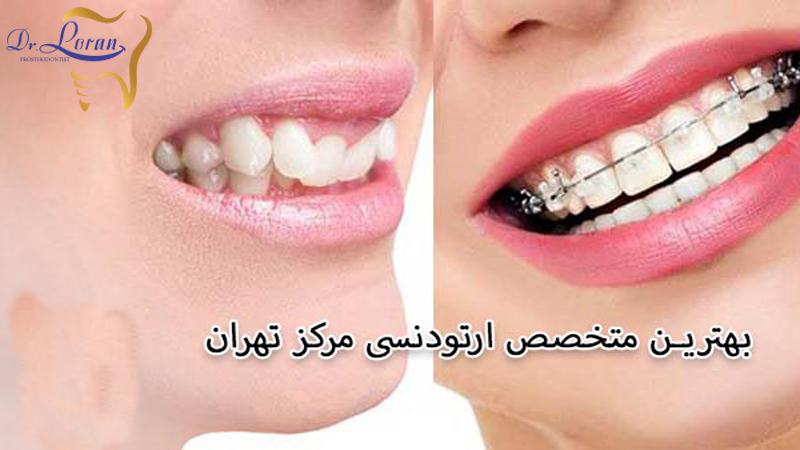بهترین مرکز پروتز دندان تهران | متخصص پروتز و زیبایی دندان تهران