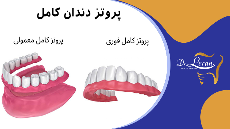 جراحی ایمپلنت دندان توسط متخصص پروتز دندان تهران