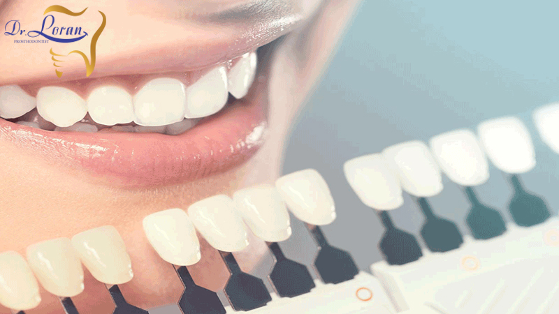 بهترین مرکز پروتز دندان تهران | دکتر ونوس لران