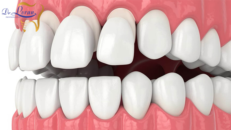 متخصص پروتز و زیبایی دندان تهران | جراحی پروتز دندان تهران