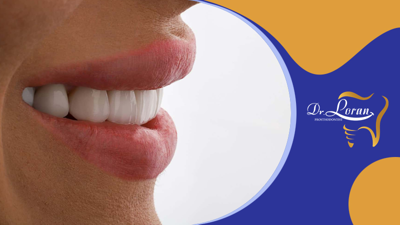 مدت زمان درمان اینویزیلاین برای صاف کردن دندان ها چقدر است؟