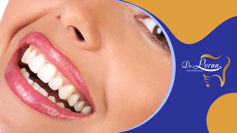 تفاوت بین سفید کردن دندان و بلچینگ دندان چیست؟