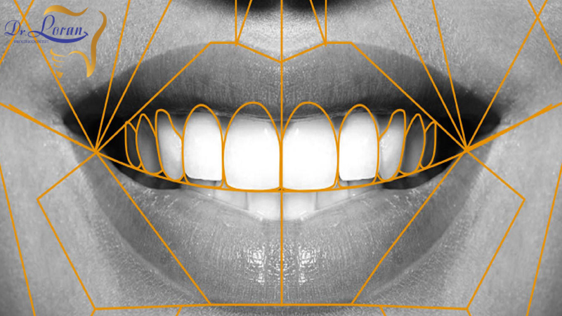 متخصص پروتز و زیبایی دندان تهران | دکتر ونوس لران در زعفرانیه