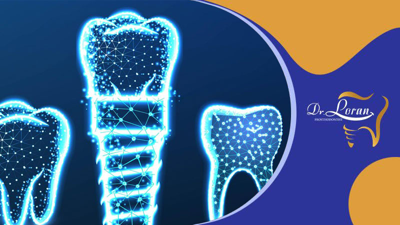تکنولوژی‌های نوین در ایمپلنت دندان: پیشرفت‌ها و کاربردها