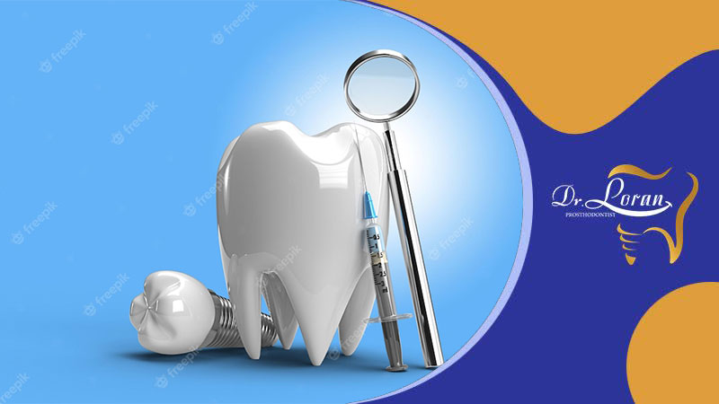 کاربرد ایمپلنت دندانی در بازسازی کامل و قسمتی دندان‌ها